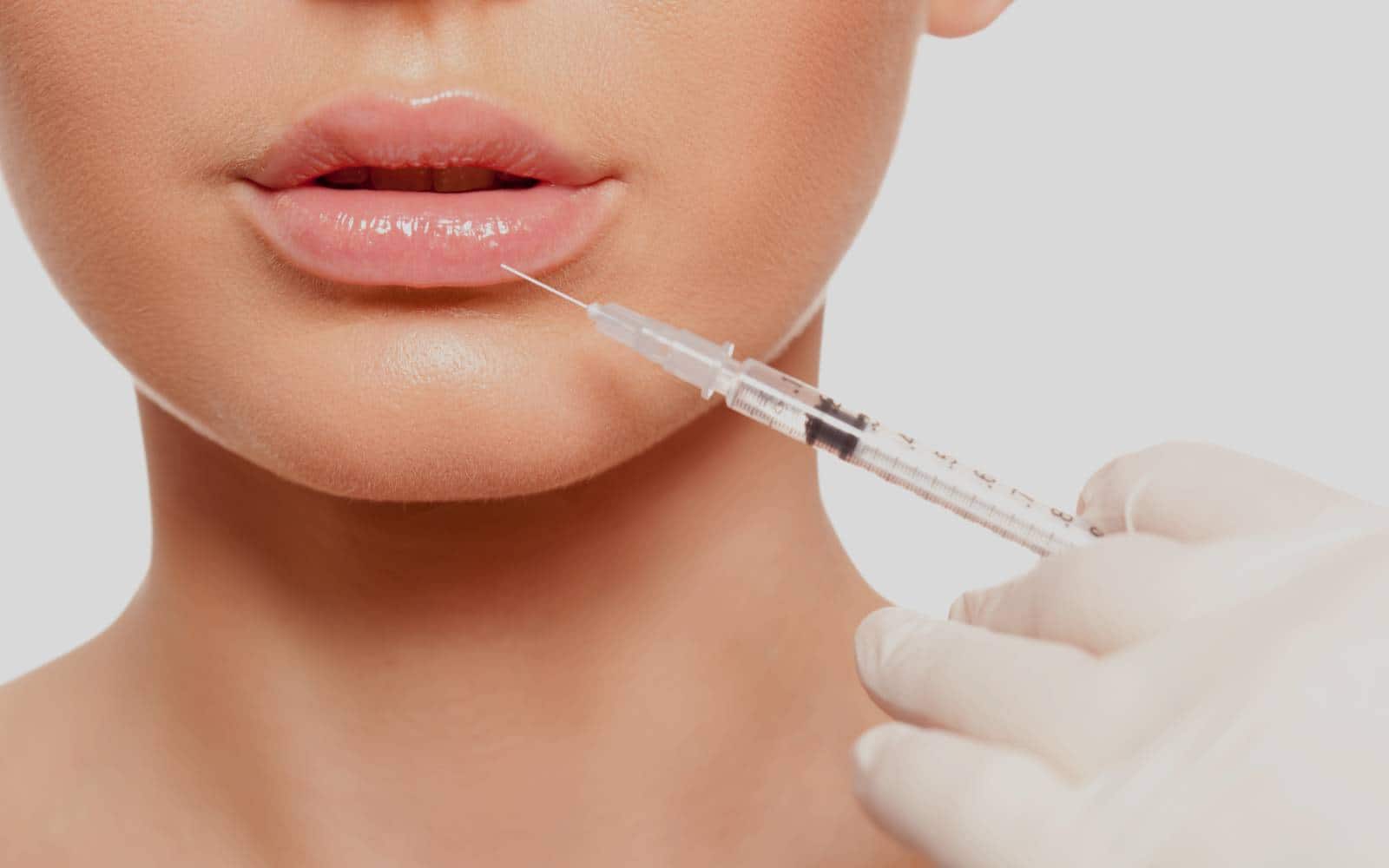 Lip Filler