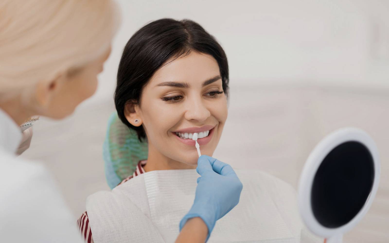 Composite Veneers